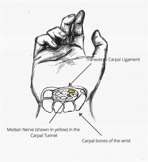 Common Conditions Carpal Tunnel Sydrome Specialised Hand Therapy