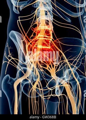 Sciatic Nerve Pain D Illustration Stock Photo Alamy