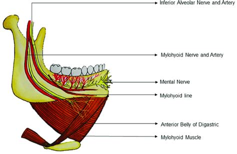 Normal Course And Distribution Of The Mylohyoid Nerve Figure Shows
