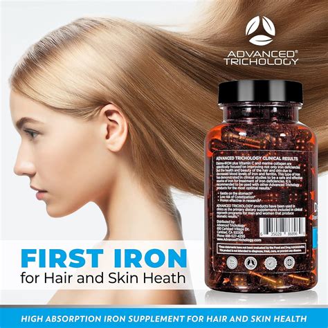 Share More Than 144 Iron Deficiency Hair Loss Reversible Vn