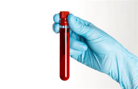 Best Blood Vial Stock Photos Pictures And Royalty Free Images Istock