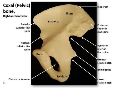 Pelvic organ prolapse in older women: Coxal (Pelvic) bone, anterior view with labels ...