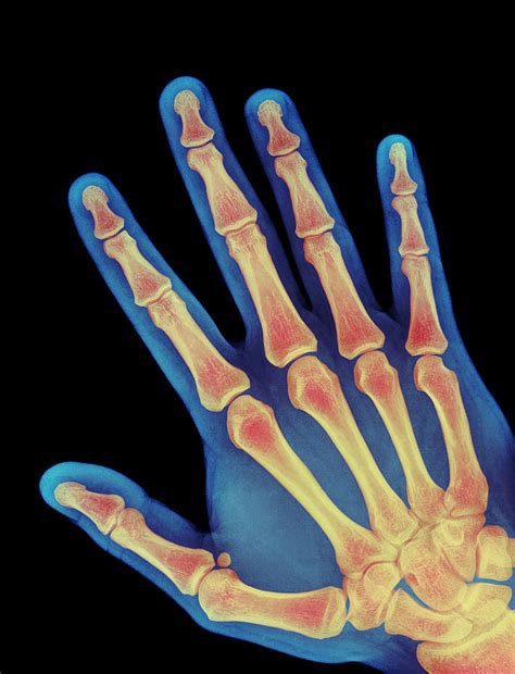 Healthy Adult Hand X Ray Photograph By Fine Art America