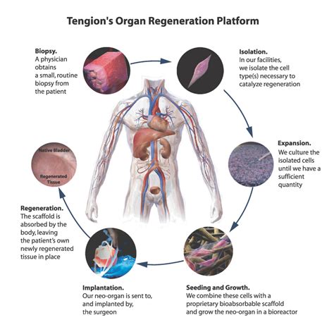 Tengion A Cautionary Tale For Regenerative Medicine Bulls Otcmkts