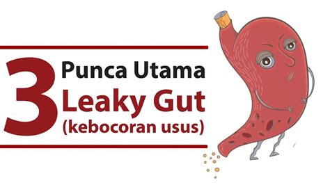 Founder well4life, cancer & diabetic cure without medicine. 3 PUNCA UTAMA kenapa kena LEAKY GUT (kebocoran usus) — Dr ...