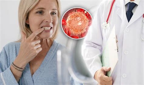 Cancer Symptoms Signs Of Mouth Tumour Include Loose Teeth Uk