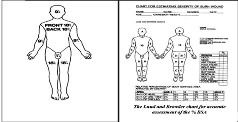 Total Body Surface Area Burn