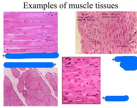 The fixed end of a muscle is called the origin of the muscle. Name the types of muscle tissues?