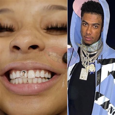 Ground Up Buzz — Chrisean Rock Gets Tooth Implant With Bluefaces