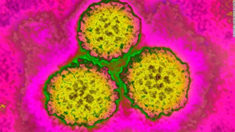 Virus Papiloma Humano ¿qué Es Vph Sus Síntomas Y Riesgos De Cáncer