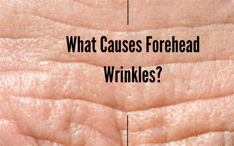 What Causes Forehead Wrinkles Skin Harmonics
