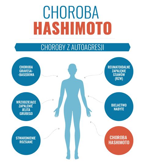 Choroba Hashimoto Czyli Przewlekłe Zapalenie Tarczycy Objawy Przyczyny Badania Pacjent