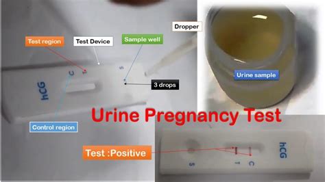 Urine Pregnancy Test Introduction Principle Procedure Result