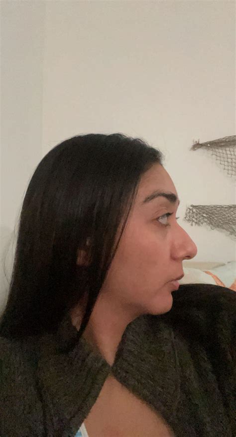 Ugliest Pic Ive Taken Of My Side Profile Plus No Makeup Damn This