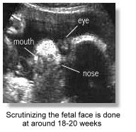 Everything About Fetal Ultrasound Faculty Of Medicine