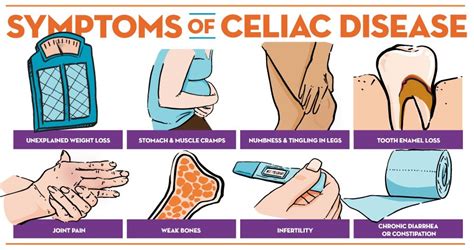 Celiac Disease Attack Symptoms Pelajaran