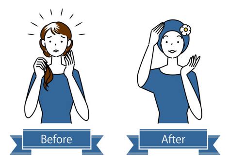 Woman With Thinning Hair Illustrations Royalty Free Vector Graphics