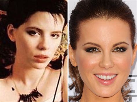 Reality Stars Plastic Surgery Transformations Before And After Vrogue