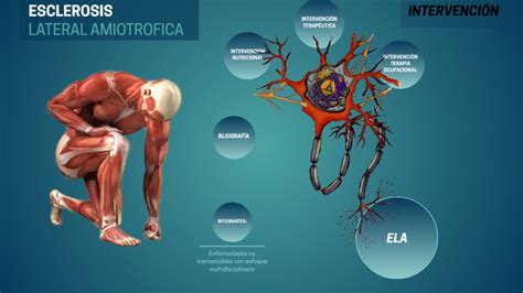 esclerosis lateral amiotrofica by jhon daza on prezi