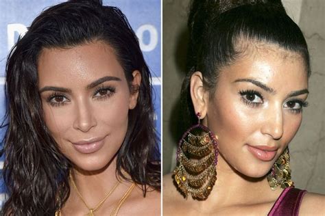 Kim Kardashians Most Extreme Plastic Surgery And Dramatic Beauty