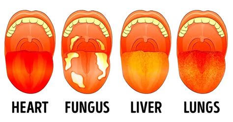 What Your Tongue Says About Your Health Health And Healthy Life