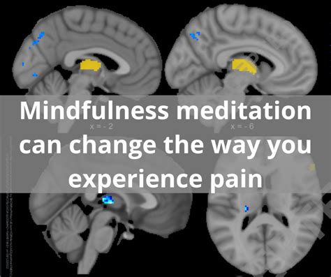Mindfulness Meditation Can Change The Way You Experience Pain Center