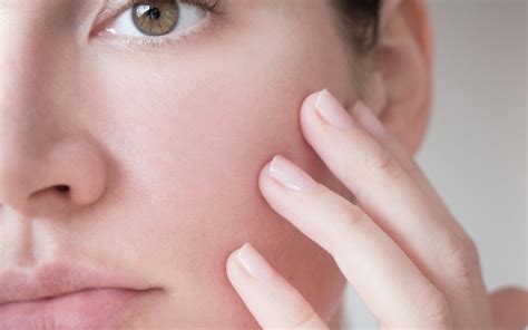 Pore Size Refinement Dr Joycelim Dermatologist And Skin Specialist