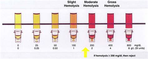 Hemolysis Chart
