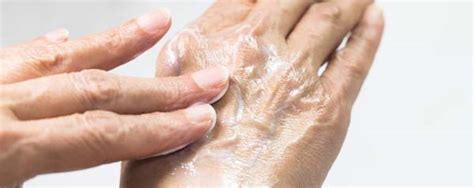 5 Tips To Help Dry Cracked Skin On Hands