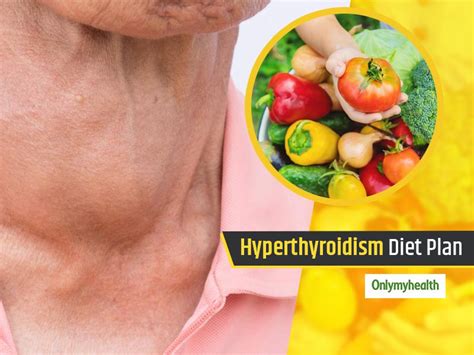 Overactive Thyroid Treatment Hyperthyroidism Diet Plan By Dietician