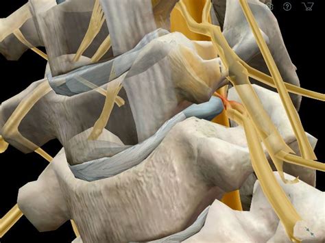 Cervical Radiculopathy A Pinched Nerve Radiculopathy Cervical