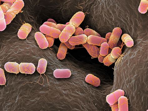 Escherichia Coli Bacteria Photograph By Martin Oeggerli Science Photo Library