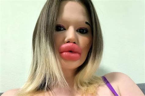 Woman With World S Biggest Lips On Hunt For A Man But Admits She S