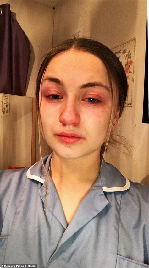 Nhs Worker 19 Shares Tearful Selfie As She Reveals Grim Reality Of