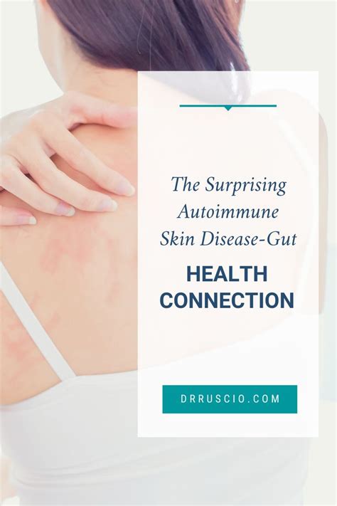 The Surprising Autoimmune Skin Disease Gut Health Connection