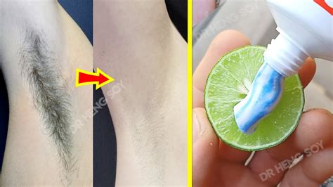 58 Top Photos Ways To Get Rid Of Armpit Hair In 3 Week Remove Unwanted Armpit Hair Permanently