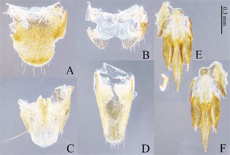 Limonius Onyx Arimoto And Suzuki Sp N Male Holotype A Tergite Viii