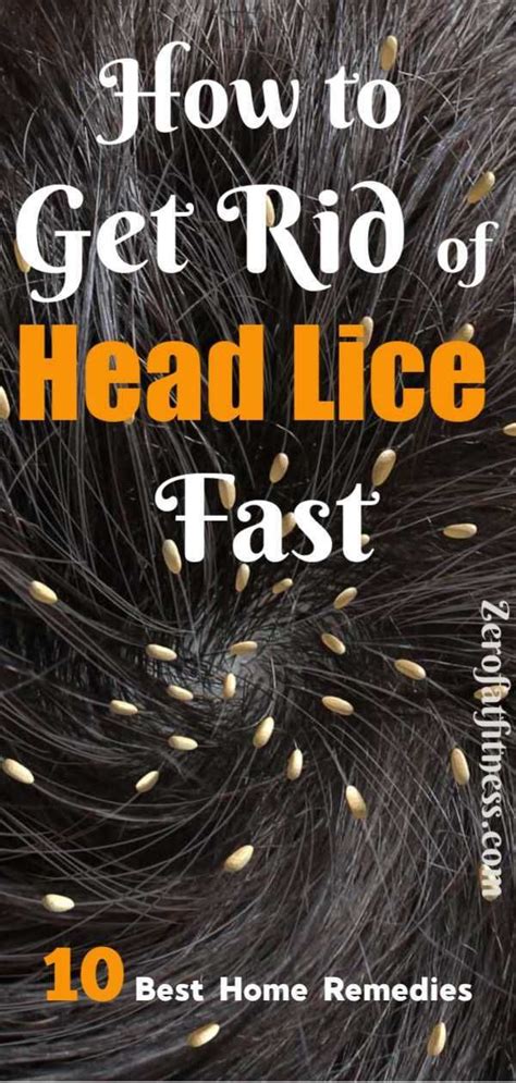 How To Get Rid Of Lice Fast 10 Best Home Remedies Home Lice Remedies