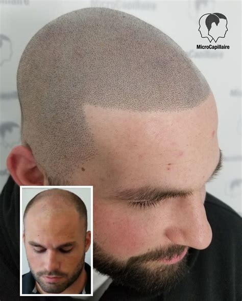 Head Tattoo Hair Scalp Tattoo Hair Tattoos Beard Styles For Men