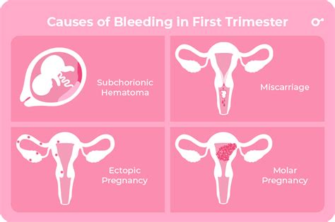 Is Heavy Implantation Bleeding Normal Or Should I Be Worried Inito