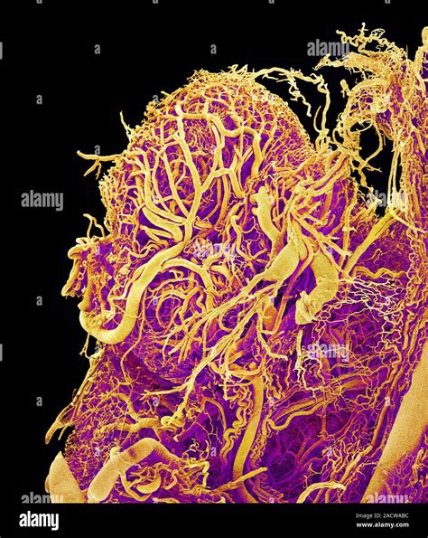 Blood Vessels Coloured Scanning Electron Micrograph Sem Of A Resin