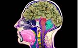 Images of How Does Marijuana Affect Your Brain Cells