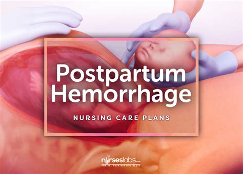 8 Postpartum Hemorrhage Nursing Care Plans Nursing Care Plan Postpartum Hemorrhage