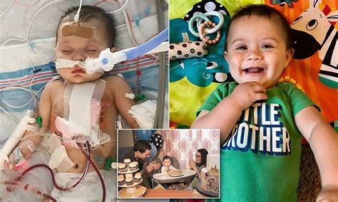 Boy Born With Hole In His Heart Celebrates First Birthday Daily Mail