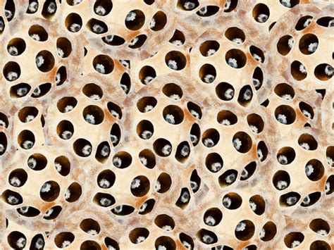 Trypophobia Meaning What Is Trypophobia All You Need To Know About The Fear Of Small Holes