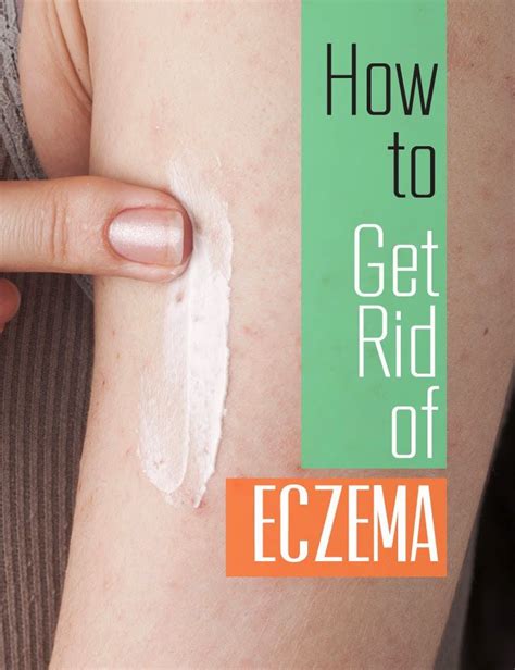 How To Get Rid Of Eczema Veda Remedies Get Rid Of Eczema How To Get Rid Eczema