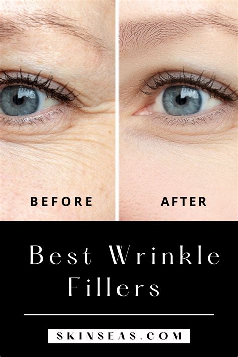 Best Wrinkles Creams Serums And Fillers In 2021 Best Wrinkle Filler