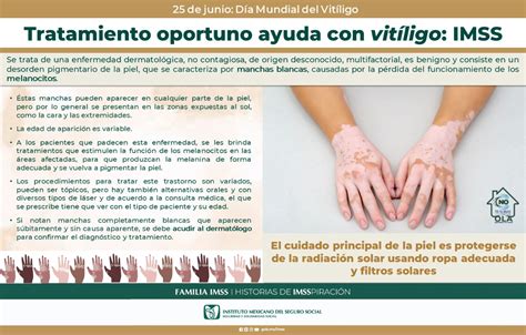 Tratamiento Oportuno Ayuda Contra Vitíligo Imss Chihuahua Centro De