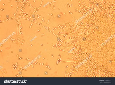 Branching Budding Yeast Cells Pseudohyphae Urine Stock Photo 370441253