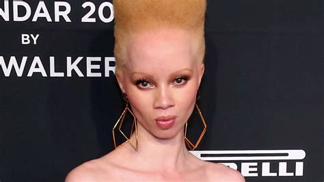 Afryka Ska Modelka Kt Ra Jest Albinosk Pierwszy Raz Pojawi A Si Na